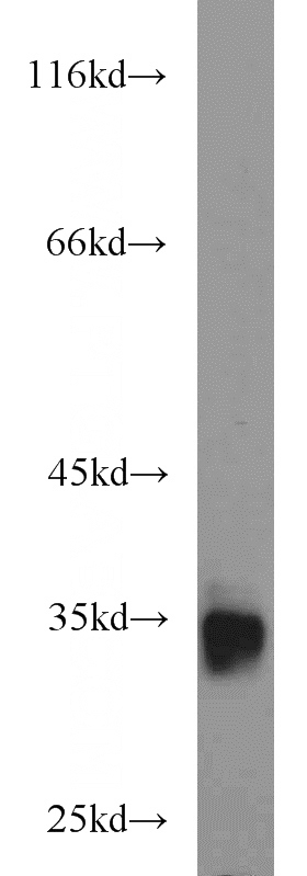 human heart tissue were subjected to SDS PAGE followed by western blot with Catalog No:108534(BST2 antibody) at dilution of 1:1000