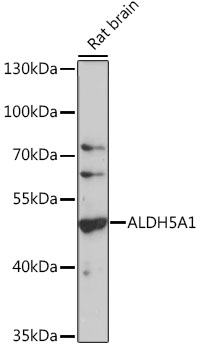 Western blot - ALDH5A1 Polyclonal Antibody 