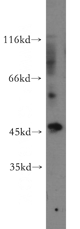 human brain tissue were subjected to SDS PAGE followed by western blot with Catalog No:115520(SOX8 antibody) at dilution of 1:300