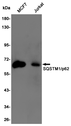 Western blot detection of SQSTM1/p62 in MCF7,Jurkat cell lysates using SQSTM1/p62 Rabbit pAb(1:1000 diluted).Predicted band size:48KDa.Observed band size:62KDa.