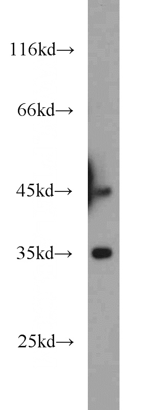 mouse brain tissue were subjected to SDS PAGE followed by western blot with Catalog No:110147(DTNBP1 antibody) at dilution of 1:1000