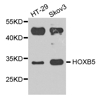 Western blot - HOXB5 Polyclonal Antibody 