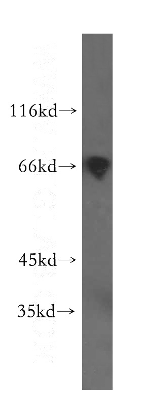 HEK-293 cells were subjected to SDS PAGE followed by western blot with Catalog No:114169(PRC1 antibody) at dilution of 1:300