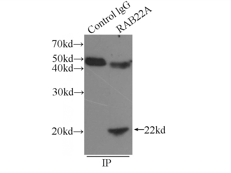 IP Result of anti-RAB22A (IP:Catalog No:114420, 3ug; Detection:Catalog No:114420 1:300) with COLO 320 cells lysate 1720ug.