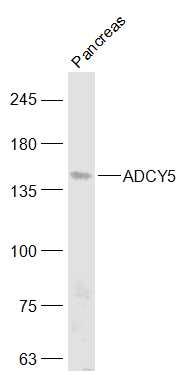 Fig1: Sample:; Pancreas (Mouse) Lysate at 40 ug; Primary: Anti-ADCY5 at 1/1000 dilution; Secondary: IRDye800CW Goat Anti-Rabbit IgG at 1/20000 dilution; Predicted band size: 139 kD; Observed band size: 139 kD