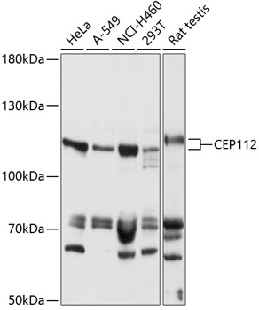 Western blot - CEP112 Polyclonal Antibody 