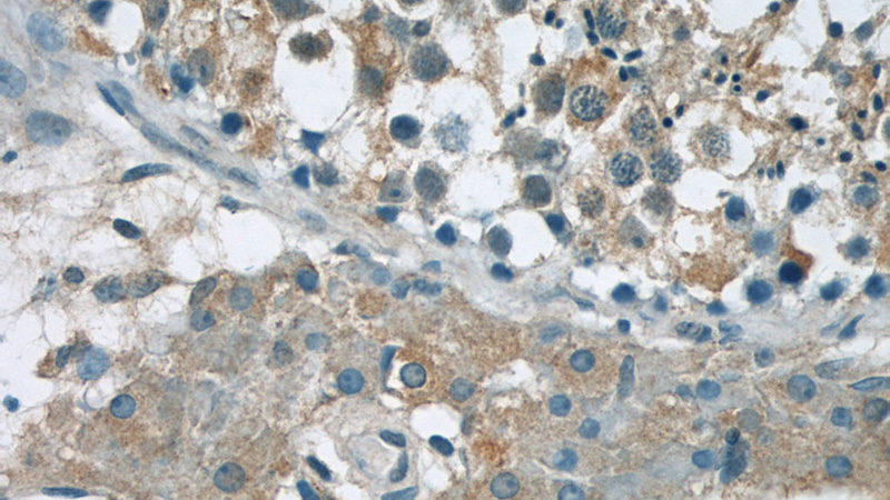 Immunohistochemistry of paraffin-embedded human testis tissue slide using Catalog No:115960(TEX15 Antibody) at dilution of 1:50 (under 40x lens)