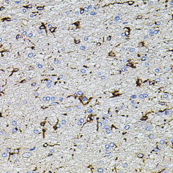 Immunohistochemistry - TRPA1 Polyclonal Antibody 