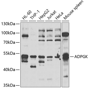 Western blot - ADPGK Polyclonal Antibody 