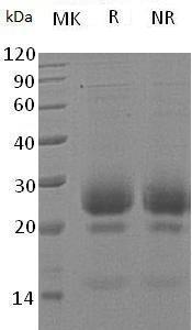 Human RNASE3/ECP/RNS3 (His tag) recombinant protein