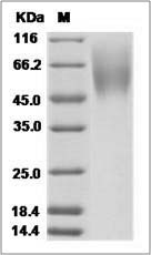 Rabbit Coagulation Factor III / Tissue Factor / CD142 Protein (His Tag)