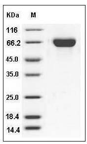 Influenza A H11N9 (A/mallard/Alberta/294/1977) Hemagglutinin / HA Protein (His Tag) SDS-PAGE