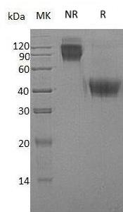 Human CSF1 (His tag) recombinant protein