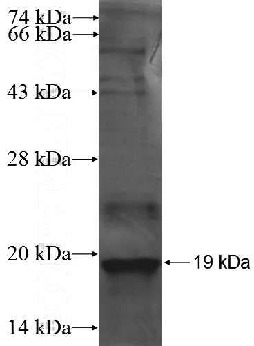 Recombinant Human NKAP SDS-PAGE