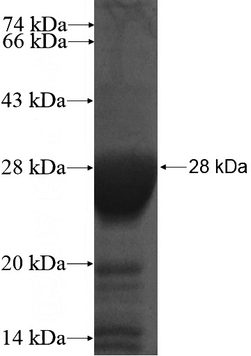 Recombinant Human TBR1 SDS-PAGE