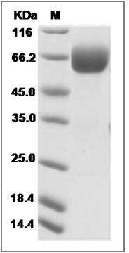 Cynomolgus Epcr / PROCR Protein (Fc Tag) SDS-PAGE