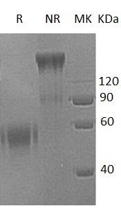 Human TNFRSF21/DR6/UNQ437/PRO868 (Fc tag) recombinant protein