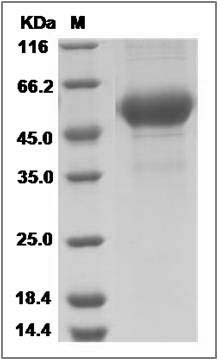 Influenza A H14N5 (A/Mallard/Astrakhan(Gurjev)/263/1982) Hemagglutinin Protein (HA1 Subunit) (His Tag) SDS-PAGE