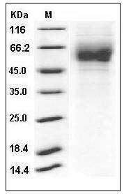 Influenza A H1N2 (A/swine/Guangxi/13/2006) Hemagglutinin Protein (HA1 Subunit) (His Tag) SDS-PAGE