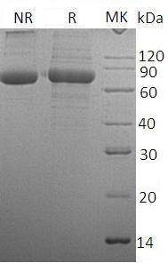 Human TPP1/CLN2/GIG1/UNQ267/PRO304 (His tag) recombinant protein