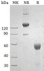 Human ULBP2/N2DL2/RAET1H/UNQ463/PRO791 (Fc tag) recombinant protein