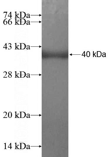 Recombinant Human CPNE4 SDS-PAGE