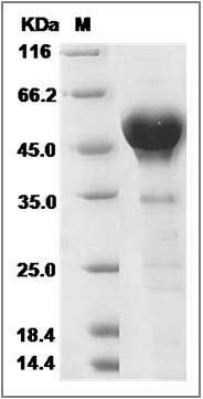 Human CALU / Calumenin Protein (His Tag) SDS-PAGE