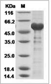 Dromedary camel coronavirus (DcCoV)(strain HKU23-368F) Nucleoprotein / DcCoV-NP Protein (His Tag)