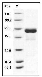 Human CALML5 / CLSP Protein (His & GST Tag) SDS-PAGE