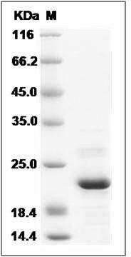 Human ARL2BP / BART1 Protein (His Tag) SDS-PAGE