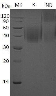 Mouse Cd244/2b4/Nmrk (His tag) recombinant protein