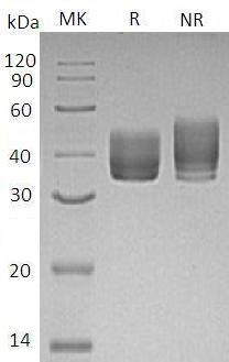 Mouse Bst1/Bp-3/Bp3/Ly65 (His tag) recombinant protein