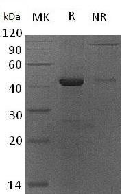 Human STN1/OBFC1 (His tag) recombinant protein