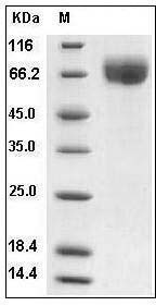 Human IFNGR1 / CD119 Protein (His & Fc Tag) SDS-PAGE
