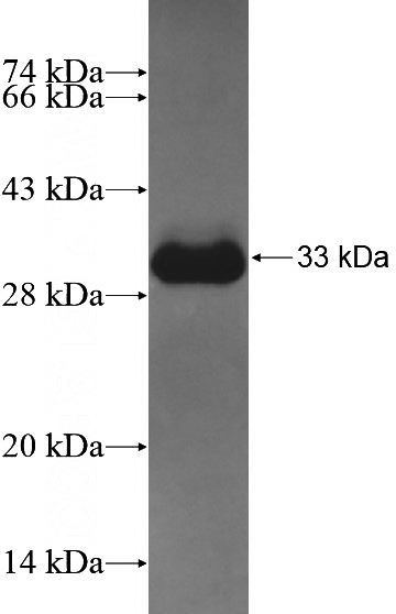 Human CHRM2 Recombinant protein (6*His tag)