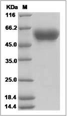 Human NTM / Neurotrimin Protein (His Tag) SDS-PAGE