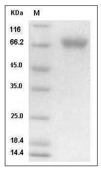 Influenza A H4N8 (A/chicken/Alabama/1/1975) Hemagglutinin / HA Protein (His Tag) SDS-PAGE