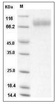 Influenza A H3N2 (A/Babol/36/2005) Neuraminidase / NA (His Tag) SDS-PAGE