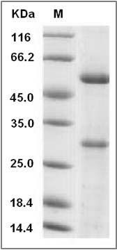 Human MFAP5 / MAGP2 Protein (His Tag) SDS-PAGE