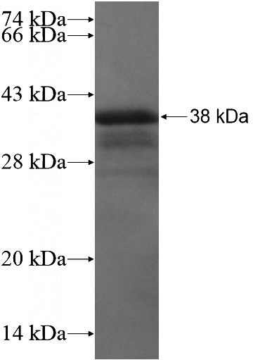 Recombinant Human ADRB1 SDS-PAGE