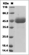 Rat SELP / P Selectin Protein (Fc Tag) SDS-PAGE
