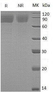 Human THPO/MGDF (His tag) recombinant protein