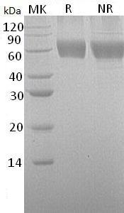 Human CSF2RA/CSF2R/CSF2RY (His tag) recombinant protein