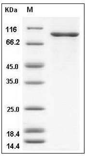Mouse CHK2 / CHEK2 Protein (His & GST Tag) SDS-PAGE