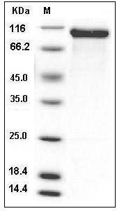 Rat HER2 / ErbB2 Protein (His Tag) SDS-PAGE