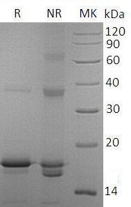 Human IL33/C9orf26/IL1F11/NFHEV recombinant protein