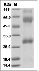 Ebola virus EBOV (subtype Zaire, strain H.sapiens-wt/GIN/2014/Kissidougou-C15) Glycoprotein / GP (Virion spike glycoprotein) Protein (His Tag)