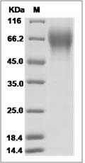Influenza B (B/Brisbane/3/2007) Hemagglutinin / HA1 Protein (His Tag)