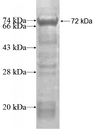 Recombinant Human RUFY2 SDS-PAGE