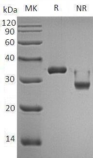 Human KLK3/APS (His tag) recombinant protein